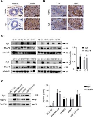 TRAF4 Inhibits the Apoptosis and Promotes the Proliferation of Breast Cancer Cells by Inhibiting the Ubiquitination of Spindle Assembly-Associated Protein Eg5